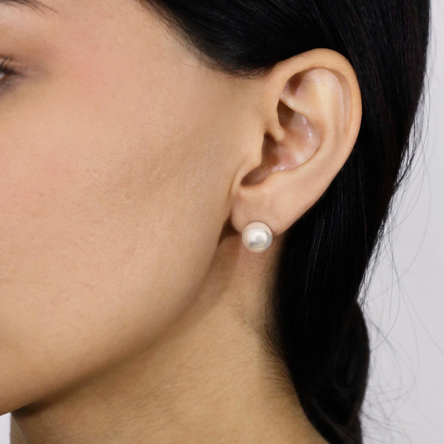 Aretes Esfera